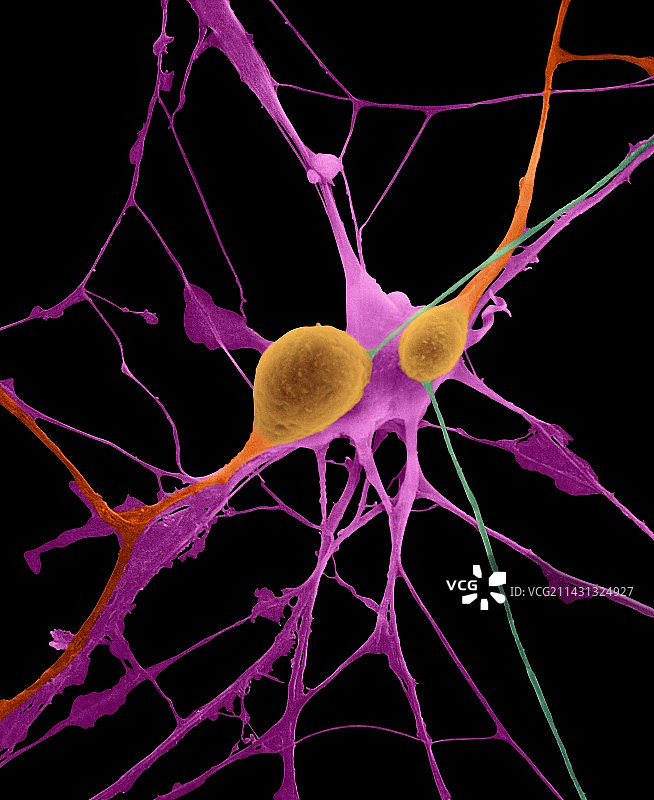 中枢神经系统的锥体神经元，扫描电镜图片素材