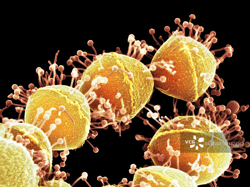 噬菌体攻击链球菌，扫描电镜图片素材