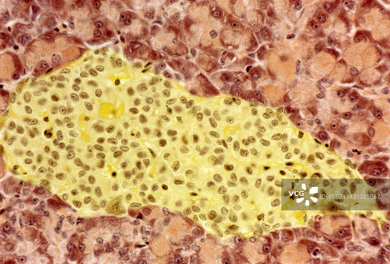 朗格汉斯岛显微照片图片素材