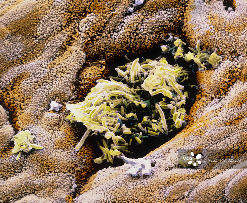 含有细菌的结肠壁的伪彩色扫描电子显微镜图像图片素材