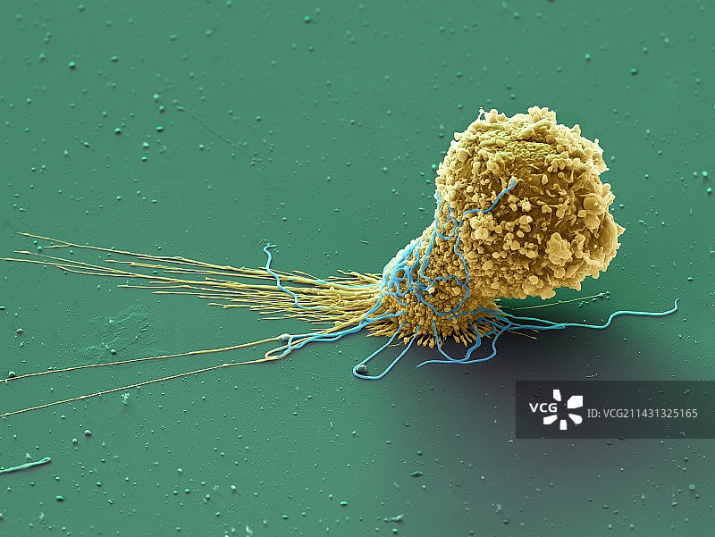 巨噬细胞吞噬细菌，SEM图像图片素材