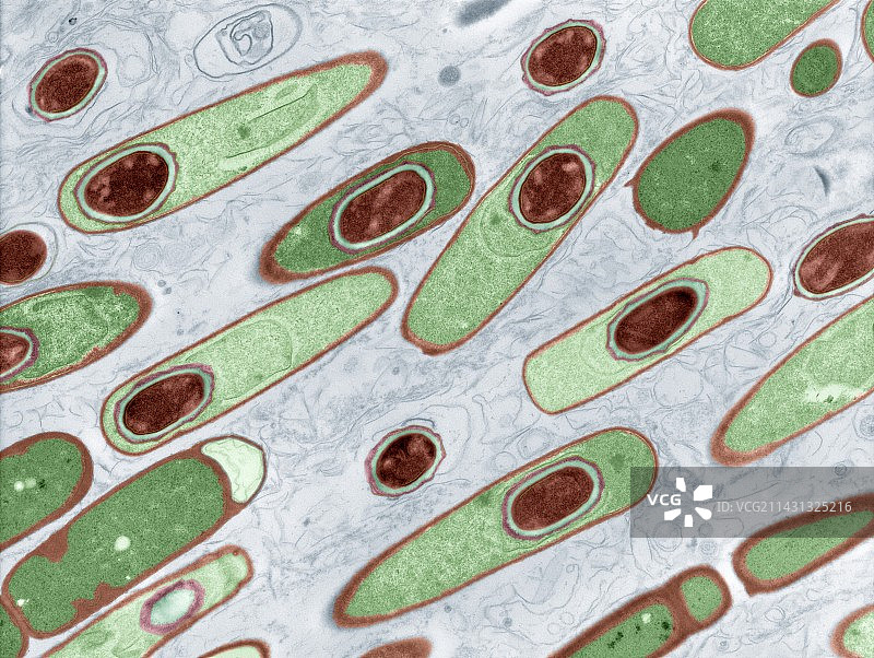 炭疽杆菌，透射电镜图片素材