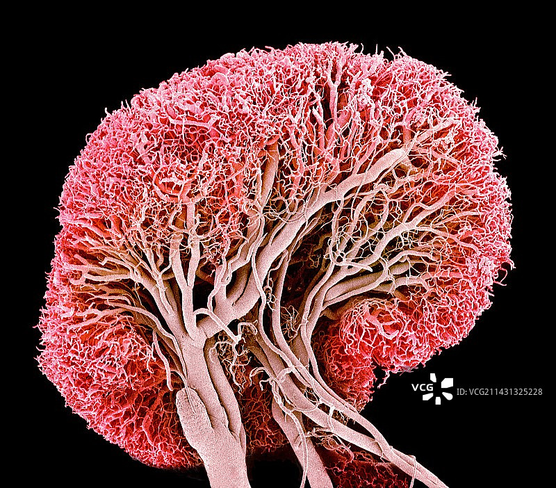 淋巴结血管，扫描电子显微镜图片素材