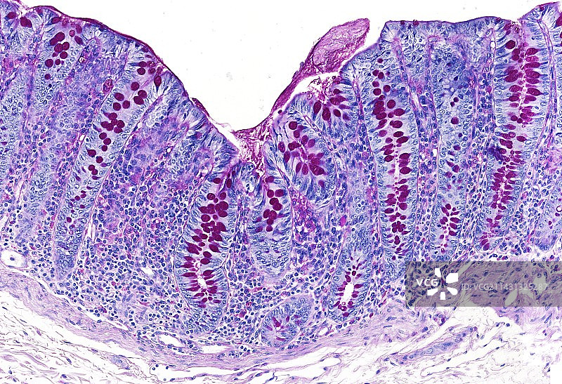 大肠显微照片图片素材