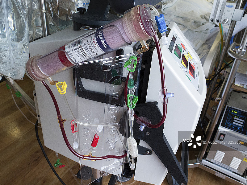 重症监护肾脏替代疗法图片素材