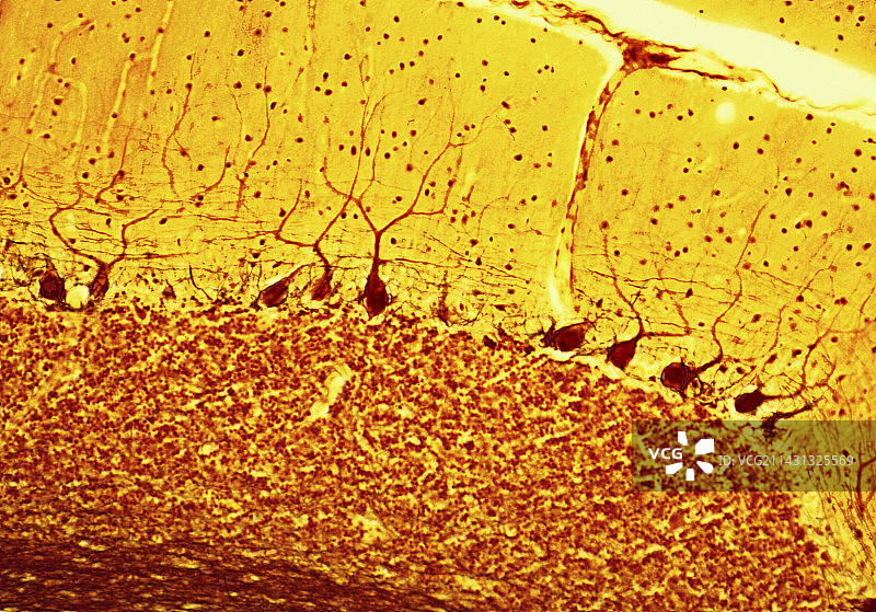 浦肯野神经细胞显微照片图片素材