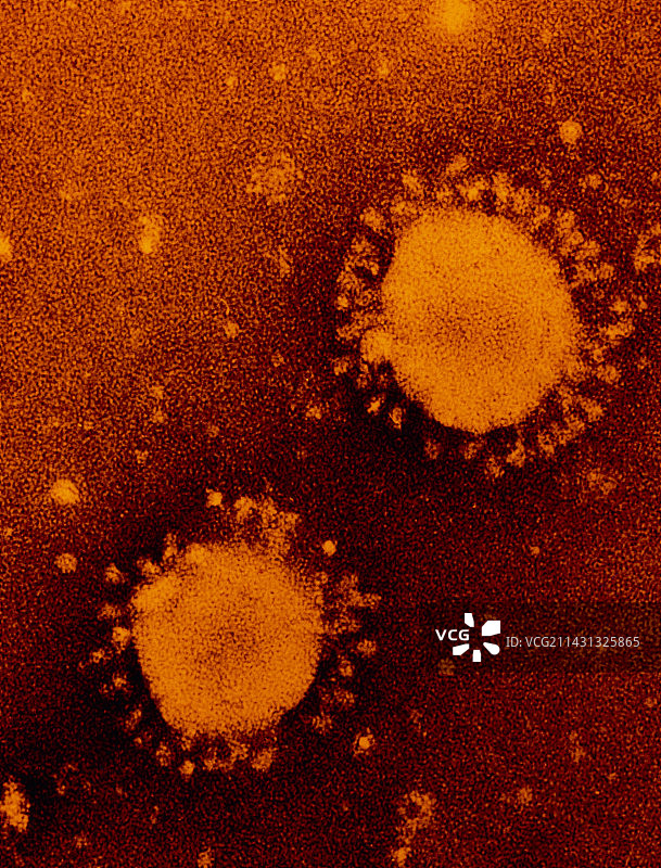 冠状病毒颗粒的伪彩色透射电镜图图片素材