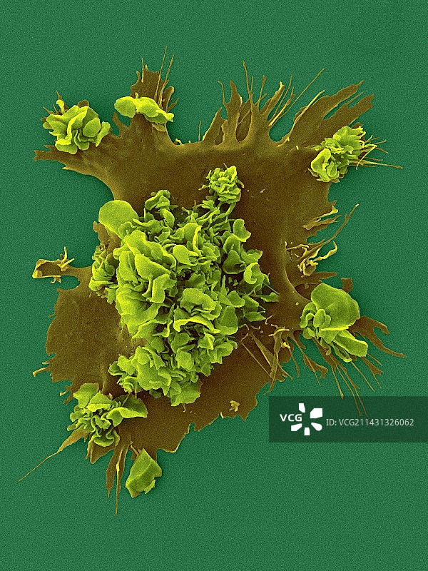 人类树突状细胞，扫描电镜图图片素材