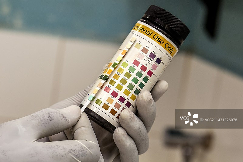 尿液测试结果图片素材