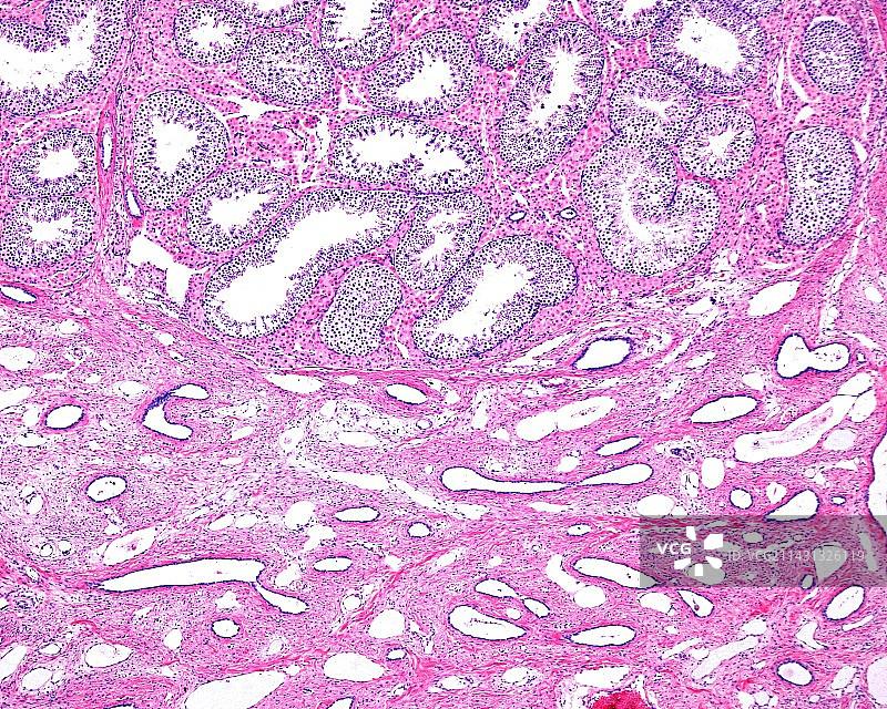 睾丸网，光学显微照片图片素材