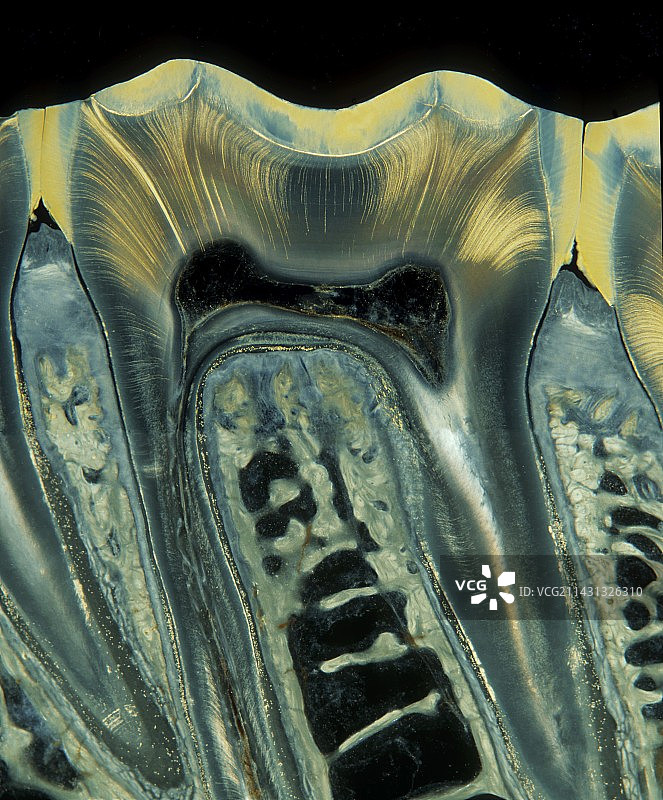 牙齿显微照片图片素材