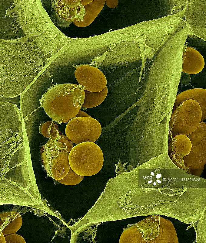 马铃薯淀粉颗粒（扫描电镜图）图片素材