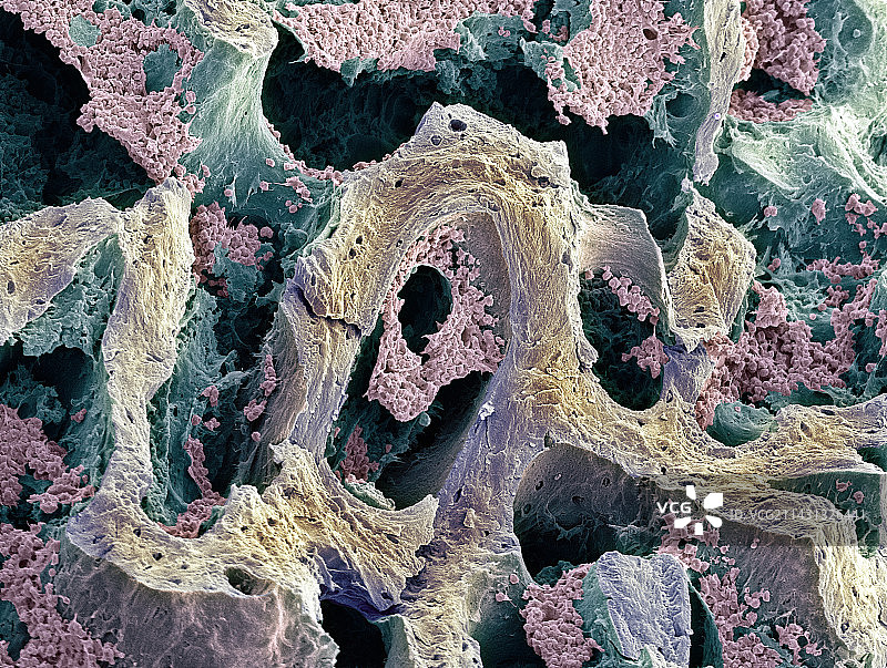 骨髓扫描电镜图图片素材