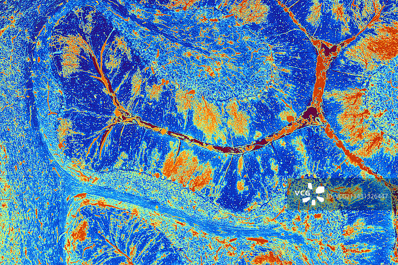 小脑组织显微照片图片素材