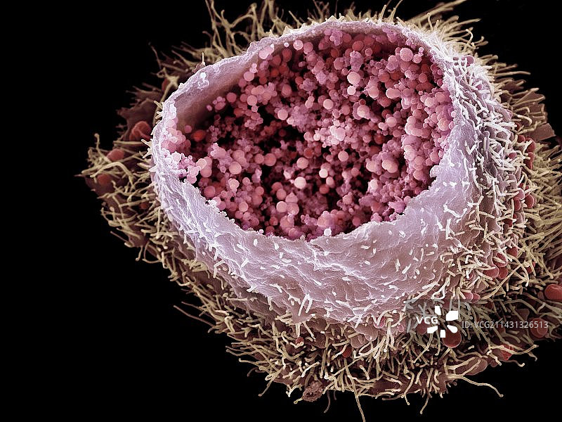 衣原体感染（扫描电子显微镜）图片素材