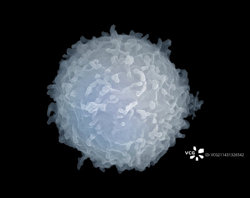 淋巴细胞扫描电镜图图片素材