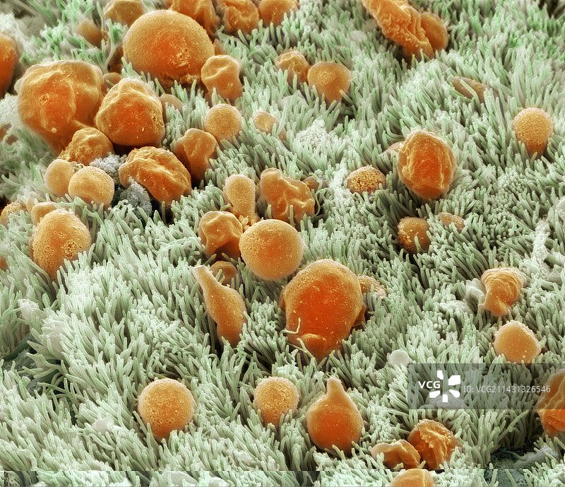 气管内壁扫描电镜图片素材