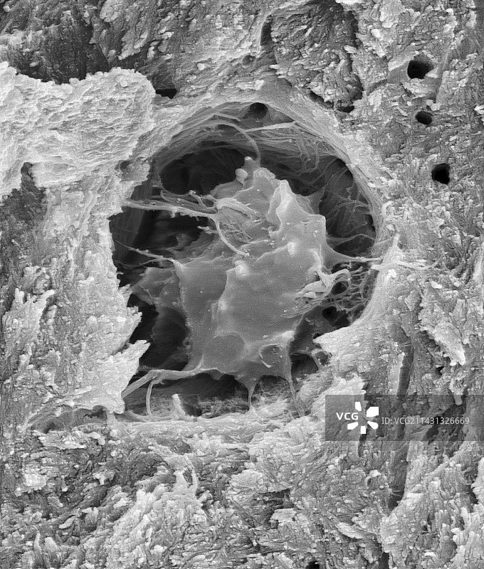密质骨中的骨细胞扫描电镜图图片素材