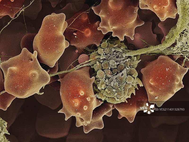 血栓扫描电镜图片素材