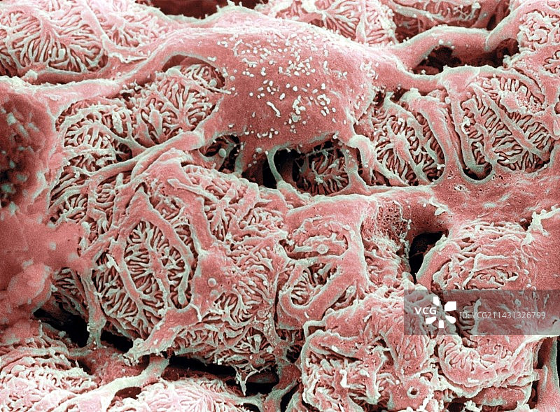 肾脏过滤，扫描电镜图片素材