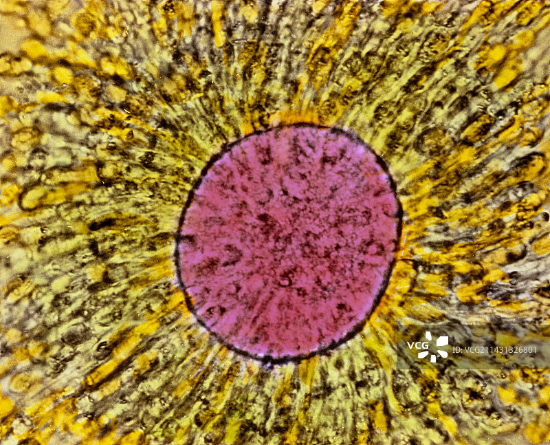 成熟人类卵母细胞的彩色光学显微镜图像图片素材