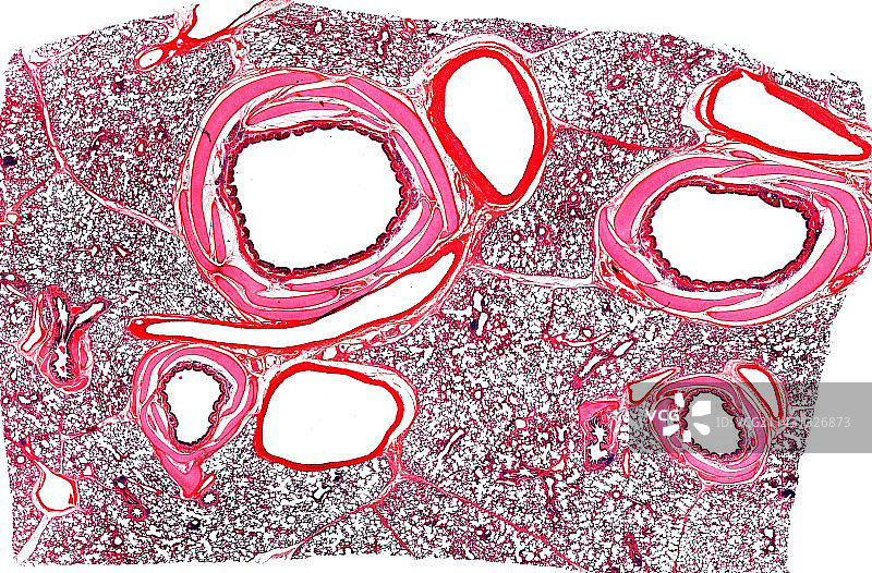 肺组织显微照片图片素材