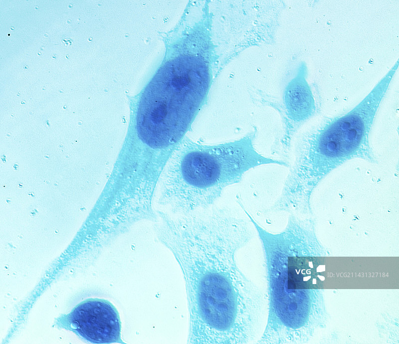 PC-3人前列腺癌细胞图片素材