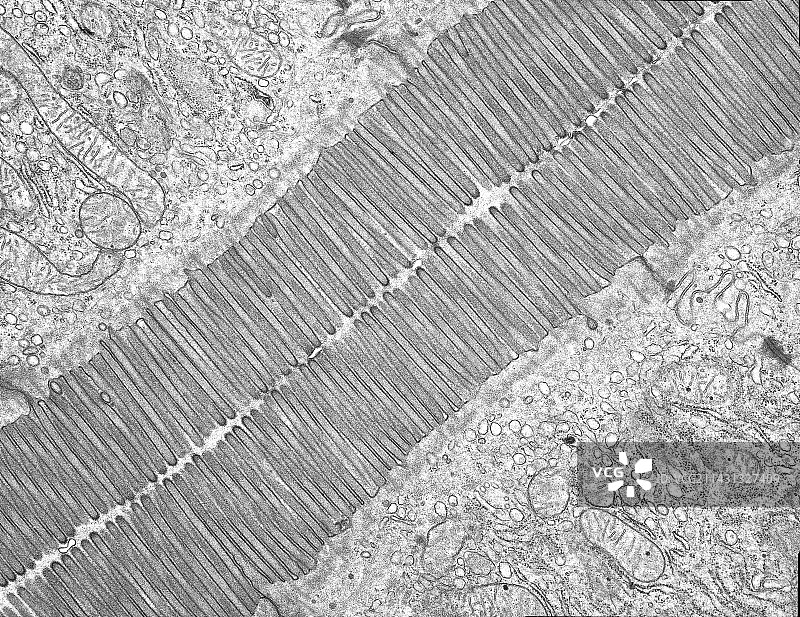 微绒毛，透射电镜图片素材