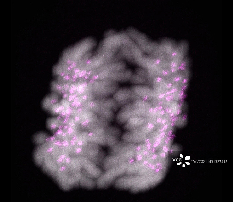 人体染色体前期分离显微照片图片素材