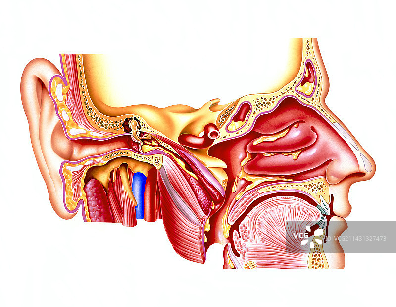 中耳炎图片素材