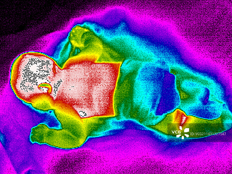 婴儿热成像图图片素材