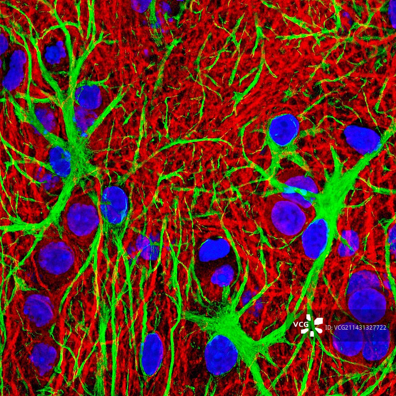 脑细胞荧光显微照片图片素材