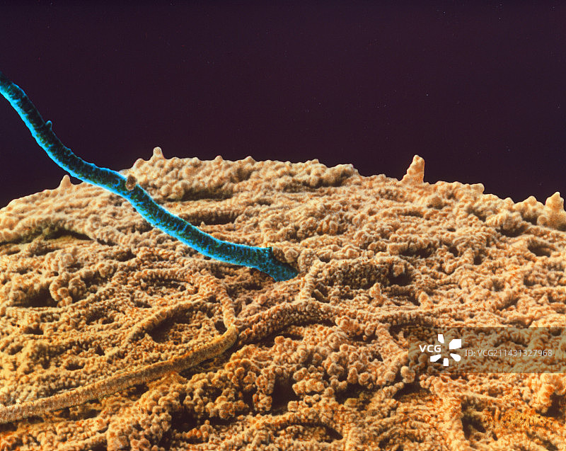 人类精子使卵子受精的彩色扫描电镜图图片素材