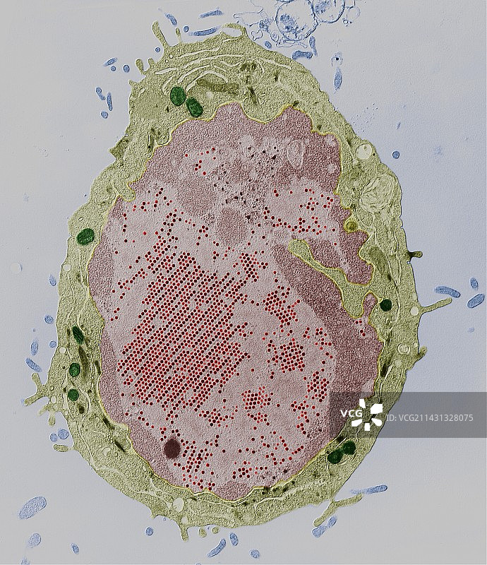 腺病毒透射电镜图图片素材