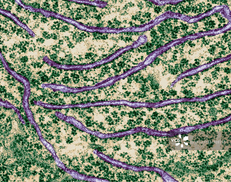 带有核糖体的粗面内质网，透射电镜图片素材