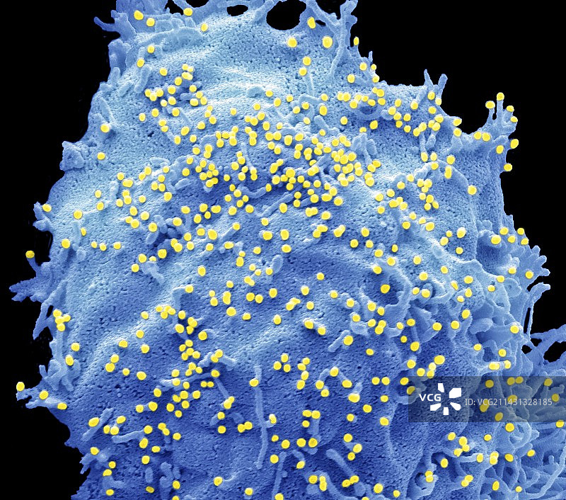 H1N1流感病毒株，扫描电子显微镜图片素材