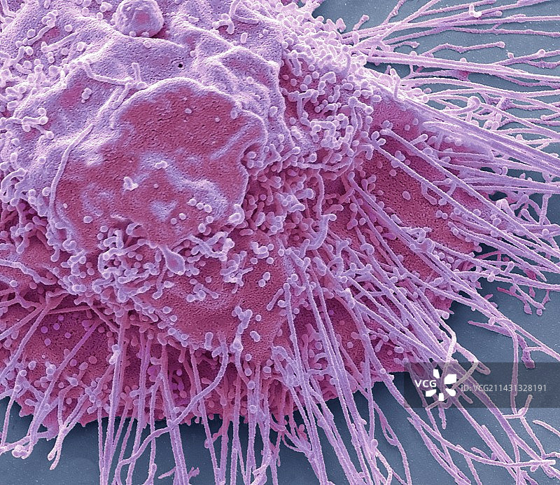 肝癌细胞 SEM图片素材