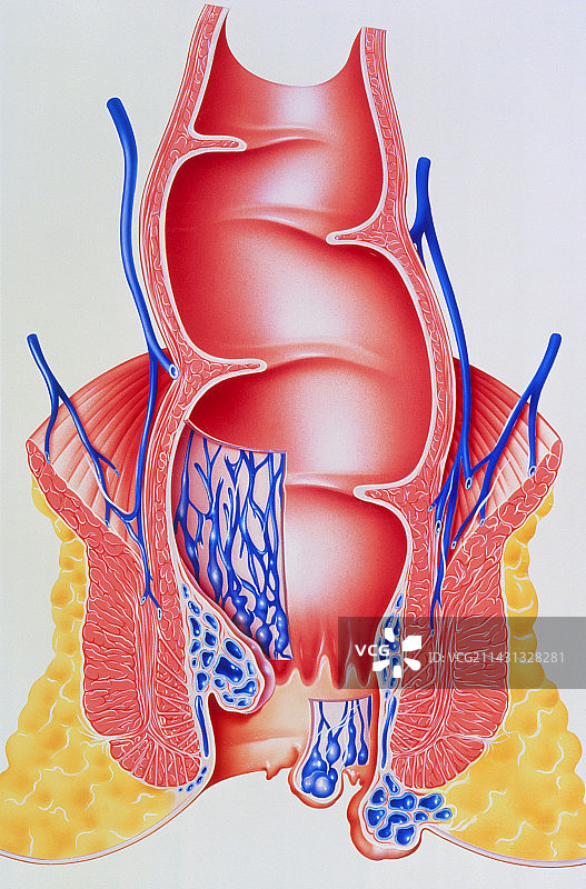 带有痔疮的肛门截面艺术作品图片素材