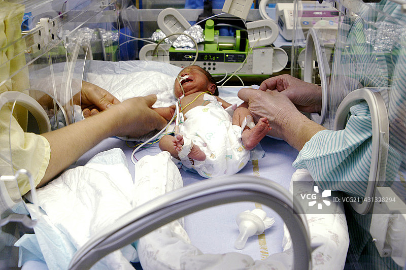 患黄疸的早产儿图片素材