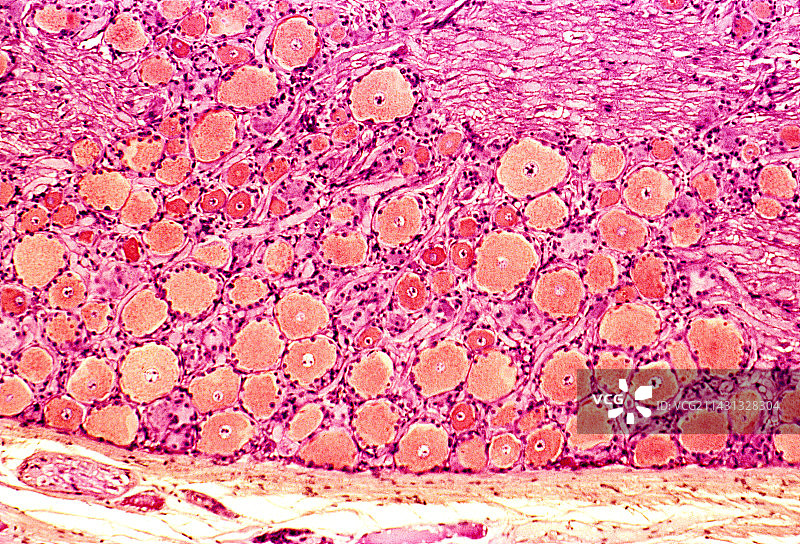 脊神经节显微照片图片素材