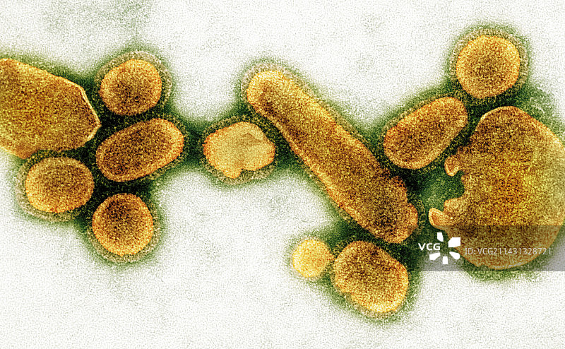 1918年H1N1流感病毒TEM图图片素材