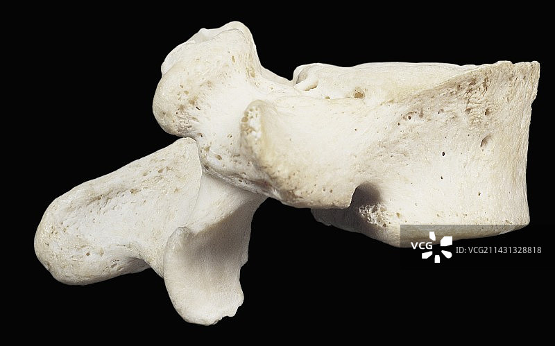 脊柱腰椎（L5）图片素材