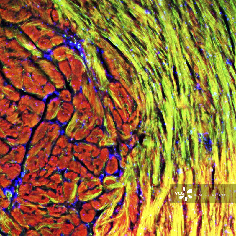 心脏肌肉荧光显微照片图片素材