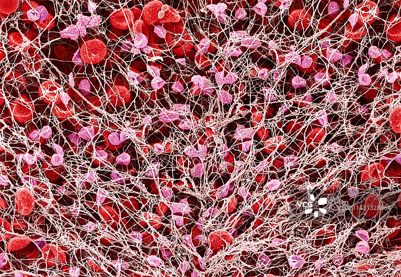 血栓扫描电镜图片素材