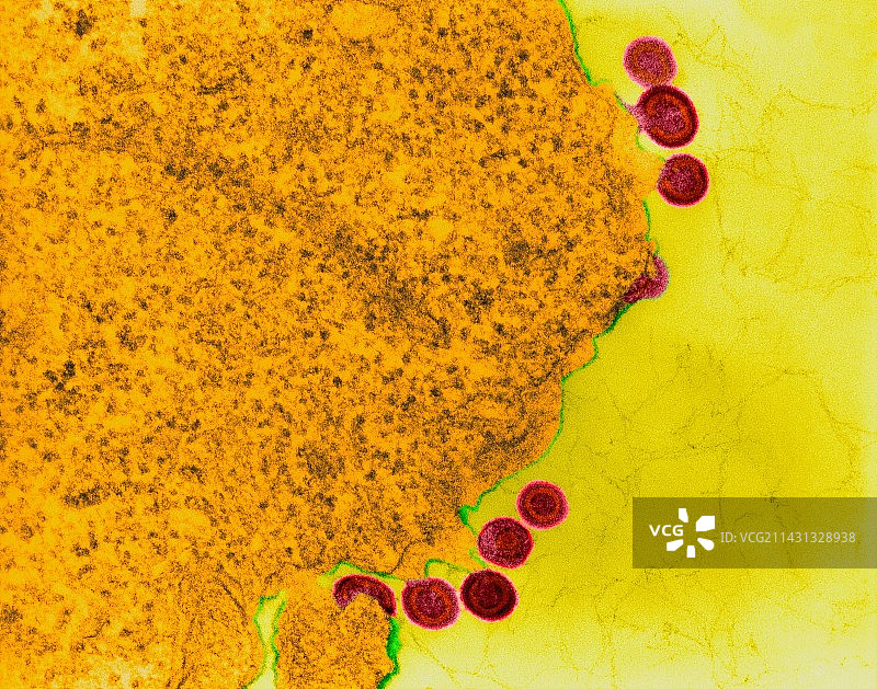 淋巴组织中的艾滋病毒感染，透射电镜图片素材