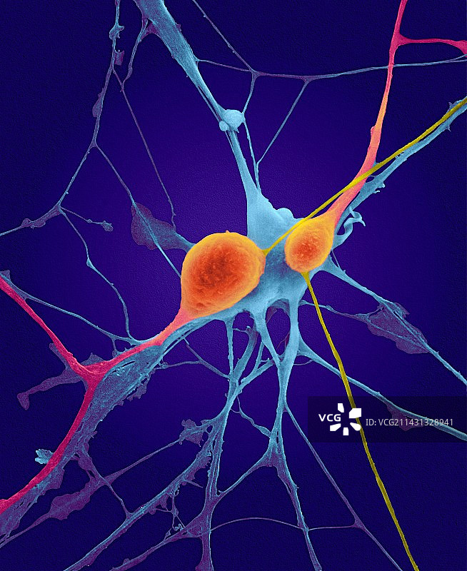 中枢神经系统的锥体神经元，扫描电镜图片素材