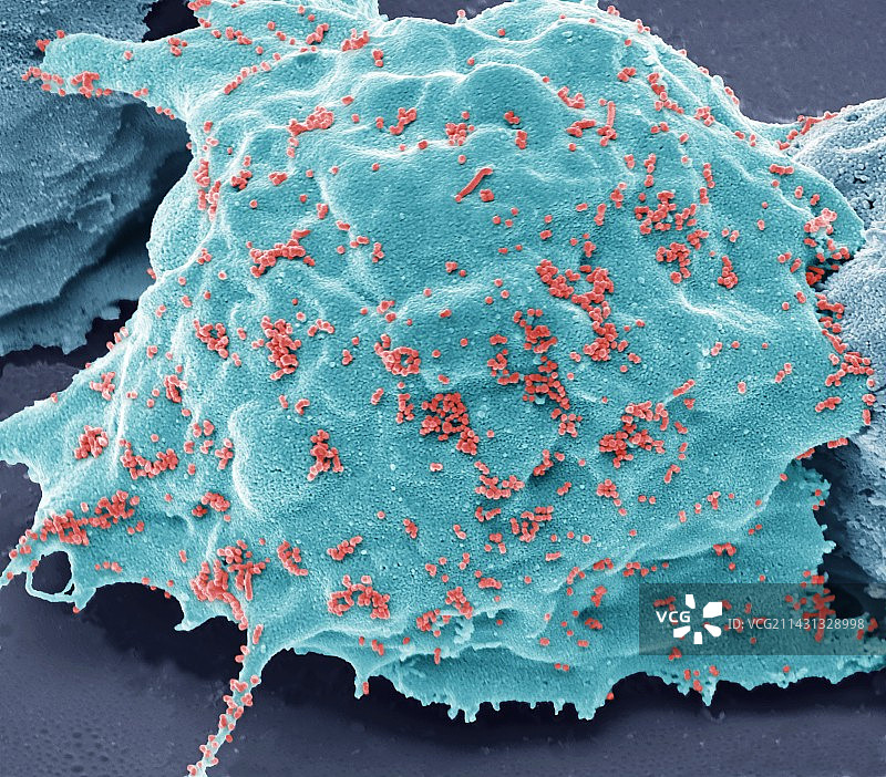 禽流感扫描电镜图图片素材