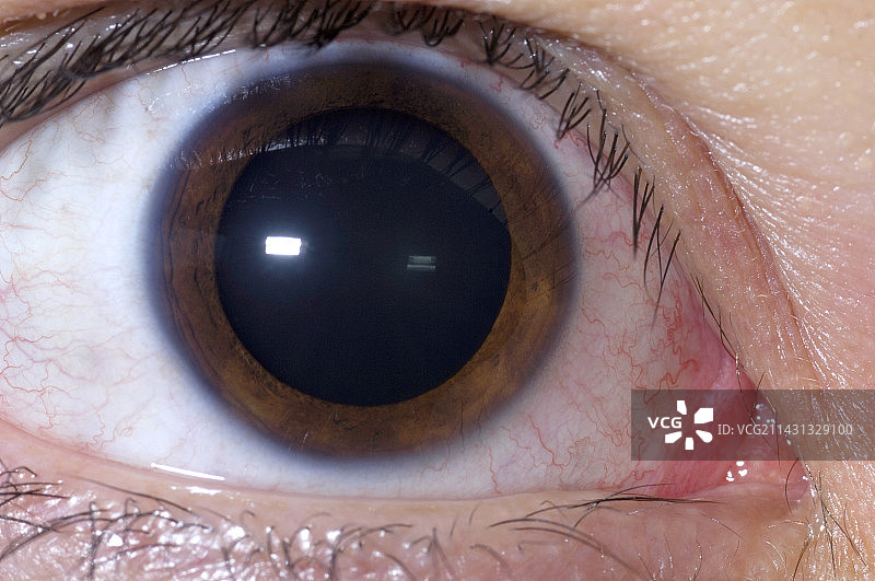 放大的瞳孔图片素材