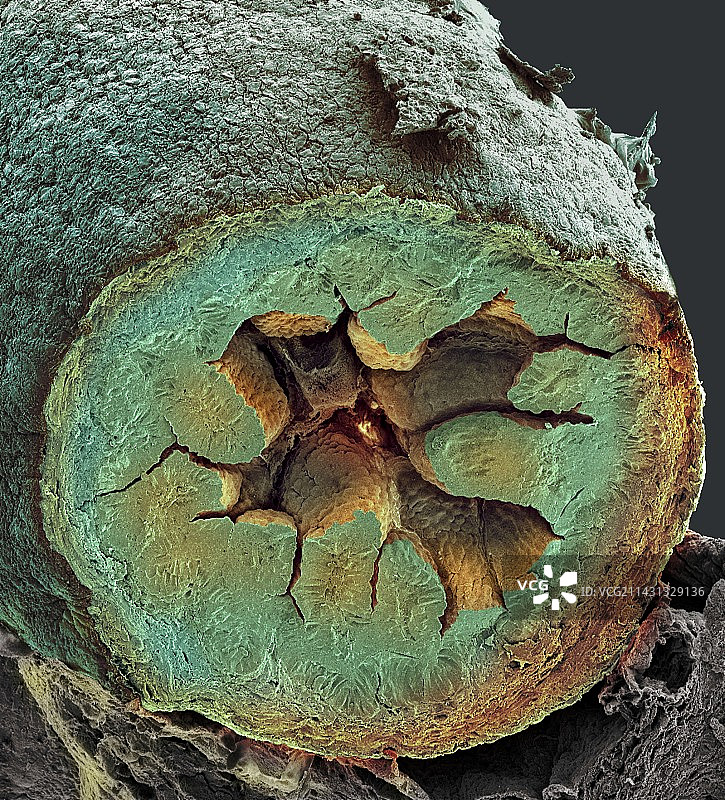 小肠扫描电镜图图片素材