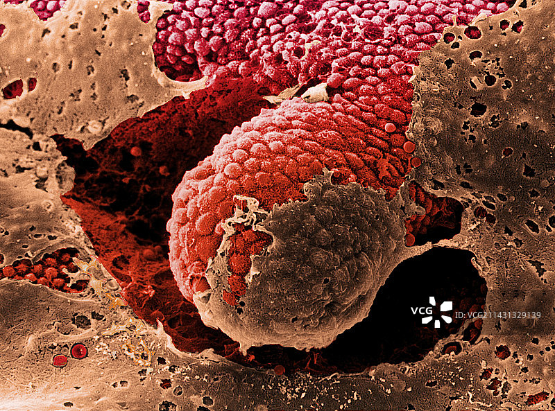 大肠粘膜的彩色扫描电镜图图片素材